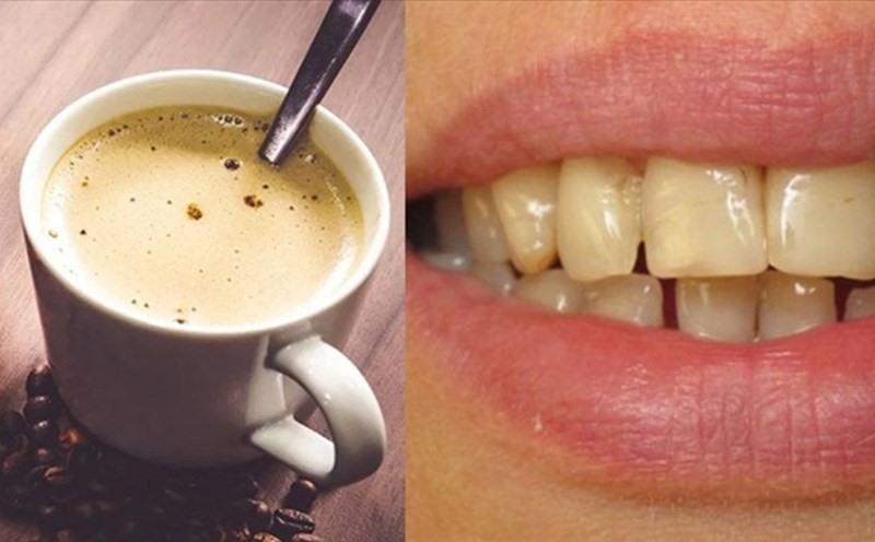 Does coffee stain your teeth